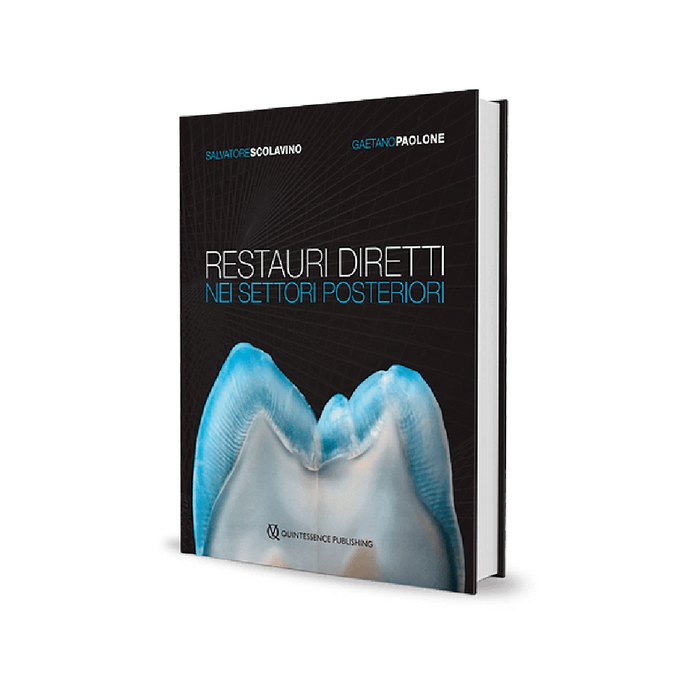Restauri diretti nei settori posteriori - ISBN 978-88-7492-062-4