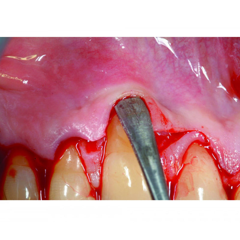 Scollaperiosteo 2 / 2,5 mm - ST-14438.00