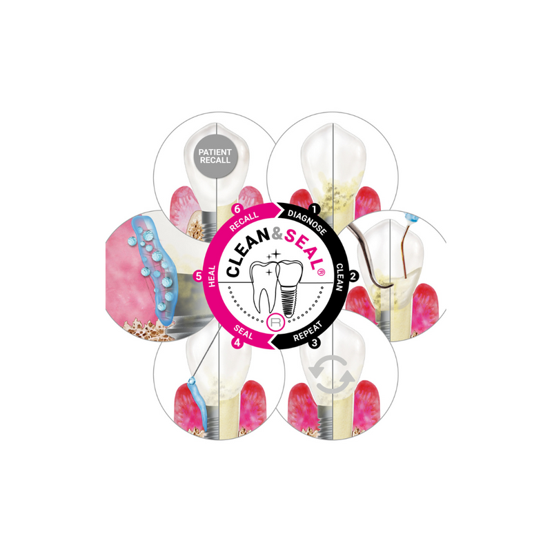 Clean&Seal® Pack