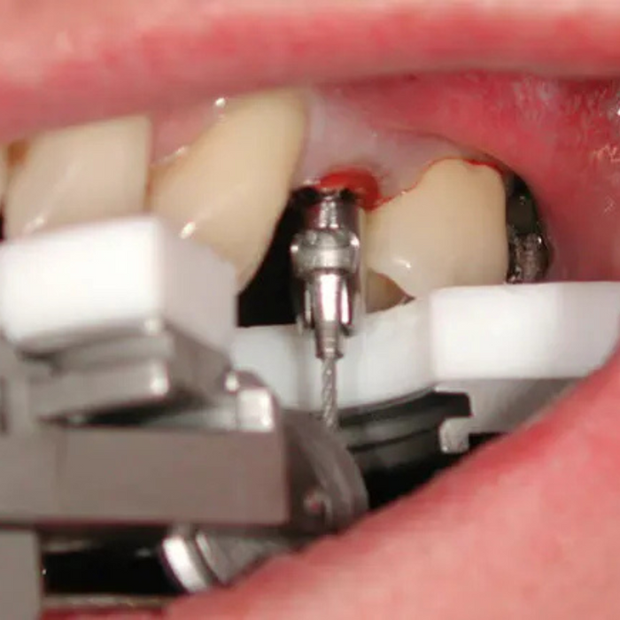Benex®-Control - CBE00