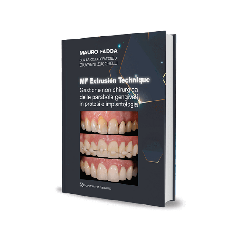 MF Extrusion Technique. Gestione non chirurgica delle parabole gengivali in protesi e implantologia - ISBN 978-88-7492-079-2