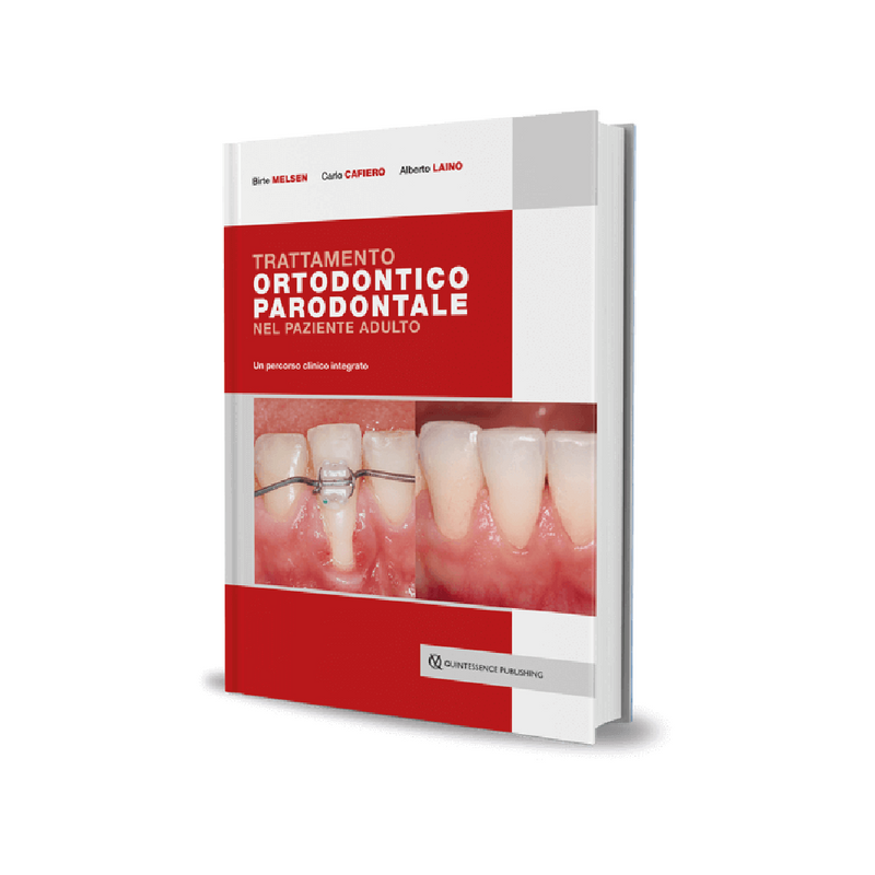Trattamento ortodontico parodontale nel paziente adulto - ISBN 978-88-7492-082-2