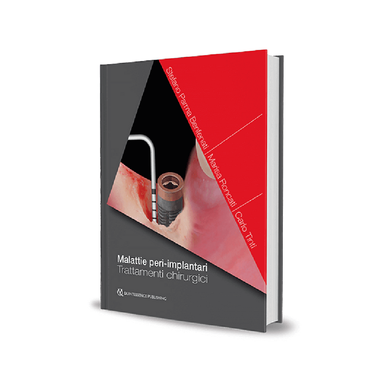 Malattie peri-implantari. Trattamenti chirurgici - ISBN 978-88-7492-064-8