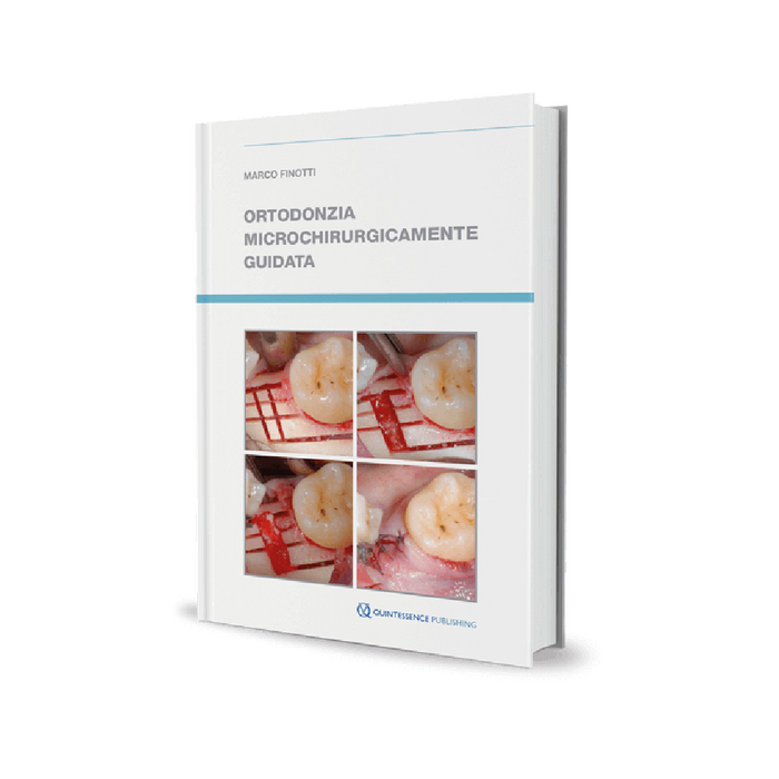 Ortodonzia microchirurgicamente guidata - ISBN 978-88-7492-042-6