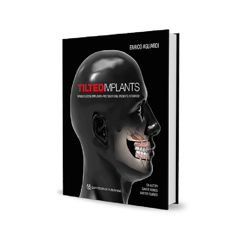 Tilted implants. Riabilitazione implantoprotesica nel paziente atrofico - ISBN 978-88-7492-059-4